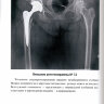 Пример страницы из книги "Рентгенодиагностический регистр по эндопротезированию тазобедренных суставов" - Г. Г. Батыгин