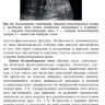 ​Пример страницы из книги "Ультразвуковая диагностика болезней вен" - Чуриков Д. А., Кириенко А. И., Ефремова О. И.