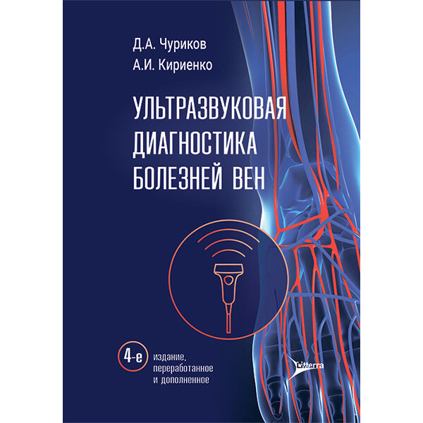 Ультразвуковая диагностика болезней вен - Чуриков Д. А., Кириенко А. И., Ефремова О. И.