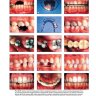 Пример страницы из книги "Биомеханика и эстетика в клинической ортодонтии" - Нанда Равиндра