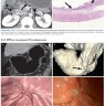 Пример страницы из книги "Лучевая диагностика заболеваний желудочно-кишечного тракта" - Пён Ин Чхве