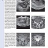 Пример страницы из книги "Диагностическая визуализация в гинекологии: в трех томах". Том 2 - Шаабан А. М.