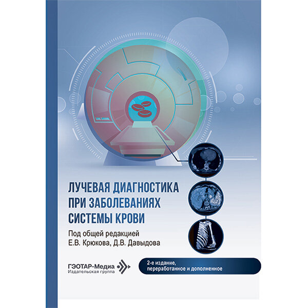 Лучевая диагностика при заболеваниях системы крови - Е. В. Крюкова, Д. В. Давыдова