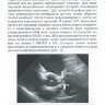 Пример страницы из книги "Эхокардиография в диагностике врожденных аномалий коронарных артерий: реальные возможности и ограничение метода. Методическое пособие" - Плахова В. В.