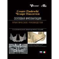 Скуловая имплантация. Практическое руководство - Чезаре Паолески