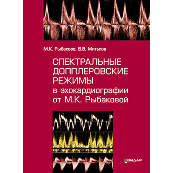 Спектральные допплеровские режимы в эхокардиографии от Рыбаковой М. К. - М. К. Рыбакова, В. В. Митьков