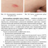 Пример страницы из книги "Дерматокосметология. Руководство для врачей" — Пономаренко И. Г.
