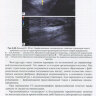 Пример страницы из книги "Ультразвуковая диагностика опухолей мягких тканей" - Труфанов Г. Е., И. Г. Пчелин, Е. А. Вецмадян