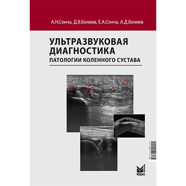 Ультразвуковая диагностика патологии коленного сустава - Сенча А. Н.