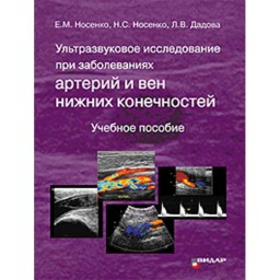Ультразвуковое исследование при заболеваниях артерий и вен нижних конечностей - Носенко Е. М.