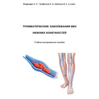 Тромботические заболевания вен нижних конечностей - Медведев А. П., Трофимов Н. А., Бабокин В. Е.