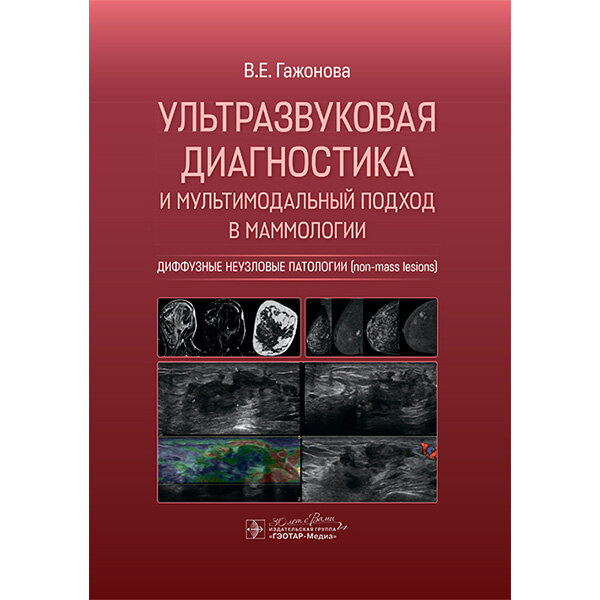 Ультразвуковая диагностика и мультимодальный подход в маммологии. Диффузные неузловые патологии (non-mass lesions) - Гажонова В. Е.