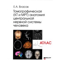 Томографическая (КТ и МРТ) анатомия центральной нервной системы человека (Атлас) - Власов Е. А.