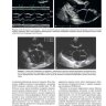 Пример страницы из книги "Эхокардиография по Харви Фейгенбауму" - Уильям Ф. Армстронг, Томас Райан