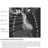 Пример страницы из книги "Лучевая анатомия. Атлас с иллюстрациями Неттера" - Вебер Э., Виленски Дж. А., Кармайкл С. У., Ли К. С.