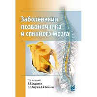 Заболевания позвоночника и спинного мозга - Щедренок В. В.