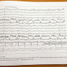 ​Пример страницы из книги "Атлас амбулаторного мониторинга ЭЭГ" - Гнездицкий В. В.