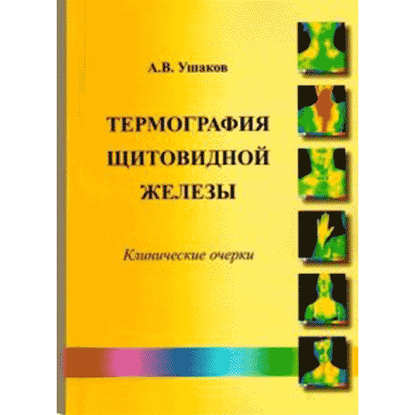 Термография щитовидной железы. Клинические очерки - Ушаков А. В.