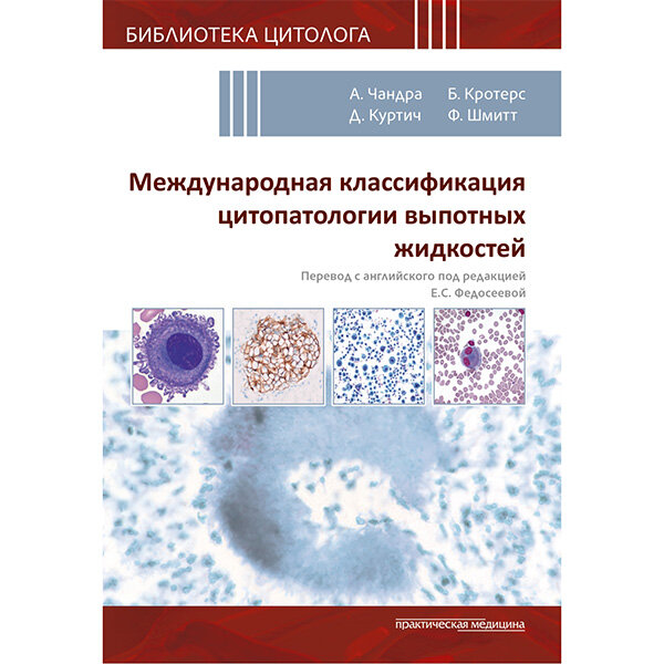 Международная классификация цитопатологии выпотных жидкостей - Чандры А., Кротерс Б., Куртича Д., Шмитта Ф.
