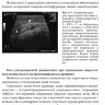 Пример страницы из книги "Руководство по ультразвуковой диагностике при заболеваниях брахиоцефальных артерий: практическое руководство для врачей" - И. В. Ганькова​