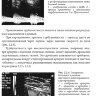 Пример страницы из книги "Руководство по ультразвуковой диагностике при заболеваниях брахиоцефальных артерий: практическое руководство для врачей" - И. В. Ганькова​