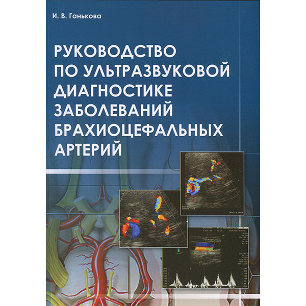 Руководство по ультразвуковой диагностике при заболеваниях брахиоцефальных артерий: практическое руководство для врачей - И. В. Ганькова