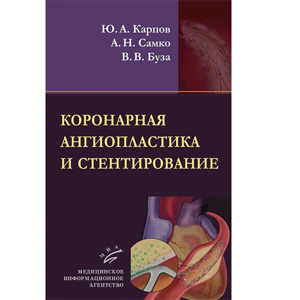 Коронарная ангиопластика и стентирование - Карпов Ю. А., Самко А. Н., Буза В. В.