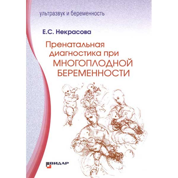 Книга "Пренатальная диагностика при многоплодной беременности ...