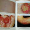 Пример страницы из книги "Детская дерматология. Справочник" - Манчини А. Дж.