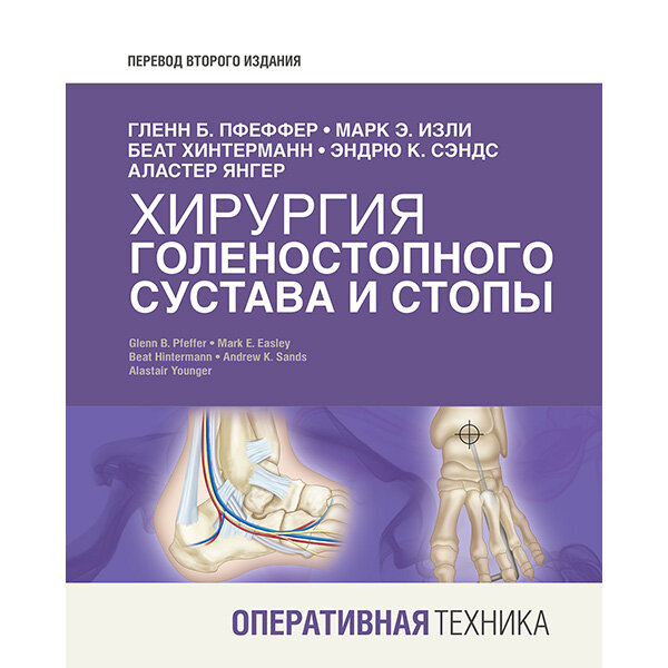 Хирургия голеностопного сустава и стопы. Оперативная техника - Гленн Б. Пфеффер, Марк Э. Изли Беат Хинтерманн, Эндрю К. Сэндс Аластер Янгер