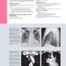 Пример страницы из книги "Лучевая диагностика. Опухоли органов грудной клетки" - Розадо-де-Кристенсон М. Л., Картер Б. В.
