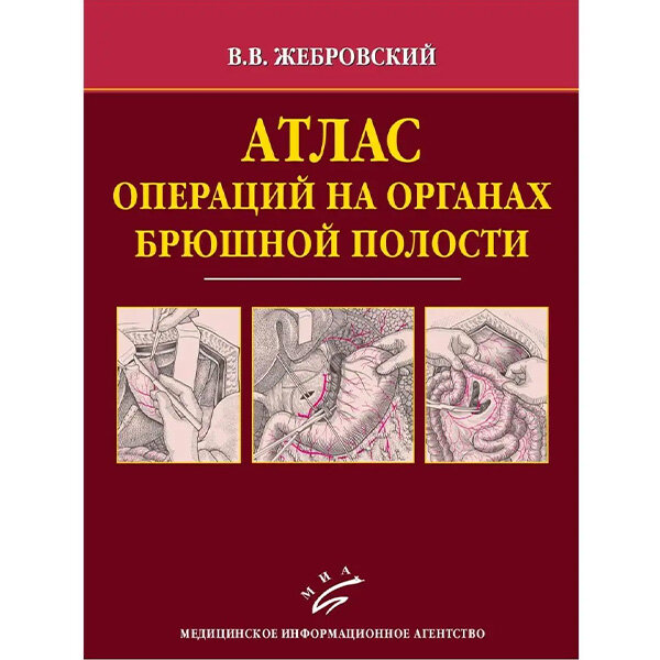 Атлас операций на органах брюшной полости - Жебровский В. В.