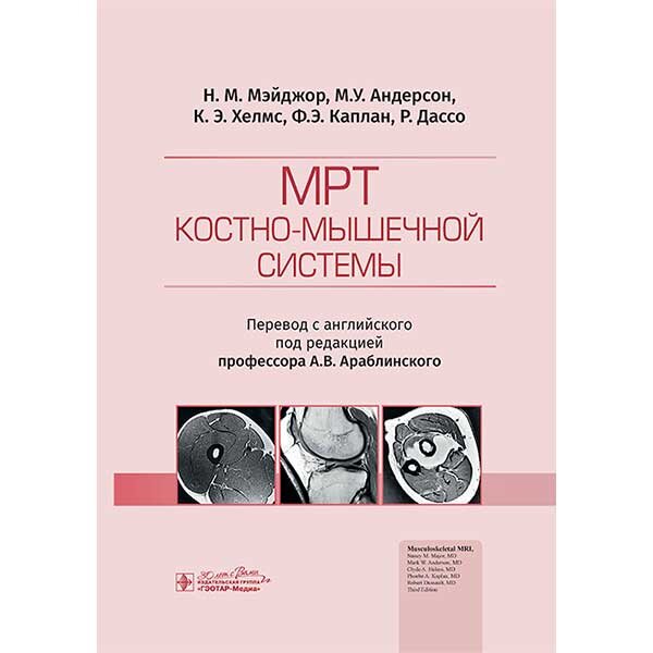 МРТ костно-мышечной системы - Н. М. Мэйджор, М. У. Андерсон, К. Э. Хелмс, Ф. Э. Каплан, Р. Дассо