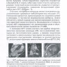 Пример страницы из книги "Компьютерная и магнитно-резонансная томография гипертрофической кардиомиопатии. Учебно-методическое пособие" - Бокерия Л. А., Дарий О. Ю., Макаренко В. Н., Асланиди И. П., Александрова С. А., Маленков Д. А.
