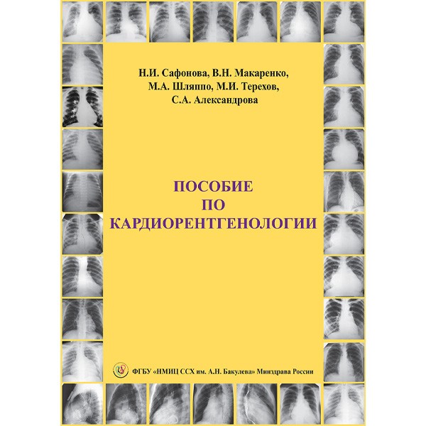 Пособие по кардиорентгенологии - Н. И. Сафонова