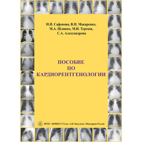 Книга "Пособие по кардиорентгенологии". Руководство по кардиологии для ...