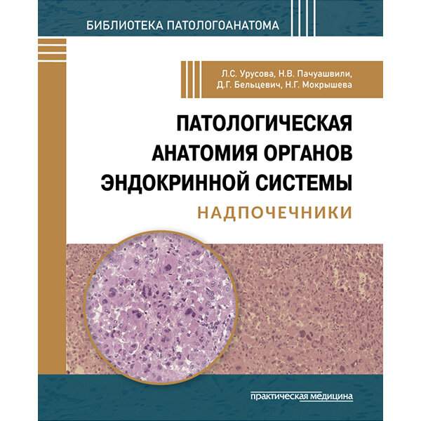 Патологическая анатомия органов эндокринной системы. Надпочечники - Урусова Л. С., Пачуашвили Н. В., Бельцевич Д. Г., Мокрышева Н. Г.