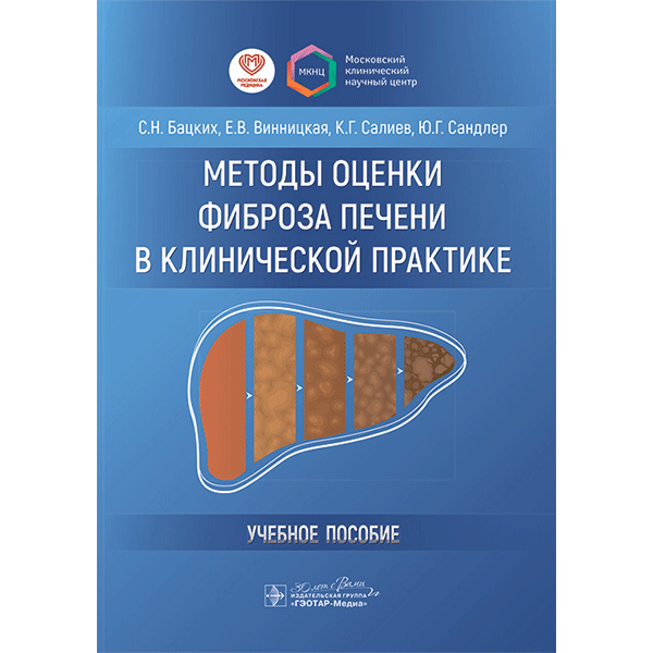 Методы оценки фиброза печени в клинической практике. Учебное пособие - Бацких С. Н., Винницкая Е. В., Салиев К. Г., Сандлер Ю. Г.