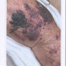 Пример страницы из книги "Сосудистые болезни кожи" - Самцов А. В.