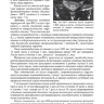 Пример страницы из книги "Головокружение. Патогенетическая реконструкция и практические рекомендации" - Самарцев И. Н., Живолупов С. А.