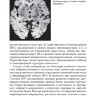 Пример страницы из книги "Малые инфаркты головного мозга" - М. Ю. Максимова, Т. С. Гулевская, В. А. Моргунов​