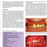 Пример страницы из книги "Болезни слизистой оболочки полости рта и губ" - Борк Конрад