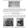 Пример страницы из книги "Морфологические предпосылки формирования одонтогенных синуситов верхнечелюстной пазухи" - Андреева И. В., Виноградов А. А., Романьков И. А.