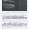 Пример страницы из книги "Современные аспекты ультразвуковой диагностики патологии брахиоцефальных артерий" - М. С. Ибрагимов, В. А. Алпенидзе