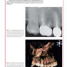 Пример страницы из книги  "Повторное лечение периапикальной патологии в эндодонтии. Клинические протоколы" - Бертани П., Гальяни М., Горни Ф.