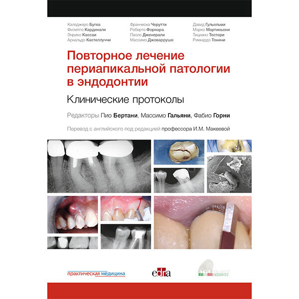 Повторное лечение периапикальной патологии в эндодонтии. Клинические протоколы -  Бертани П., Гальяни М., Горни Ф.