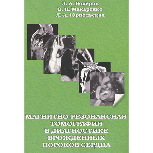 Магнитно-резонансная томография в диагностике врожденных пороков сердца - Бокерия Л. А.