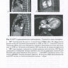 Пример страницы из книги "Магнитно-резонансная томография в диагностике врожденных пороков сердца" -  Бокерия Л. А., Макаренко В. Н., Юрпольская Л. А.