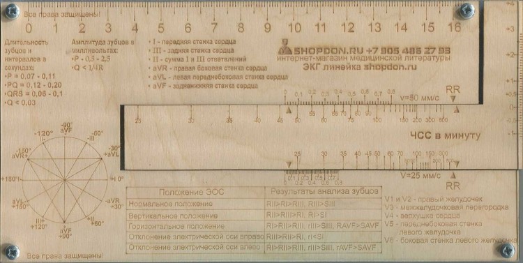 ALPHA QRS в Кардиограмме Норма