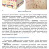 Пример страницы из книги "Детская дерматология: руководство для врачей" - Горланов И. А.